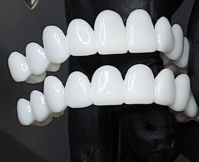 Removable Tooth Veneer with Natural Look for an Aesthetic Smile