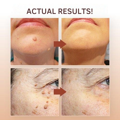 Precision Skin Care Applicator Pen