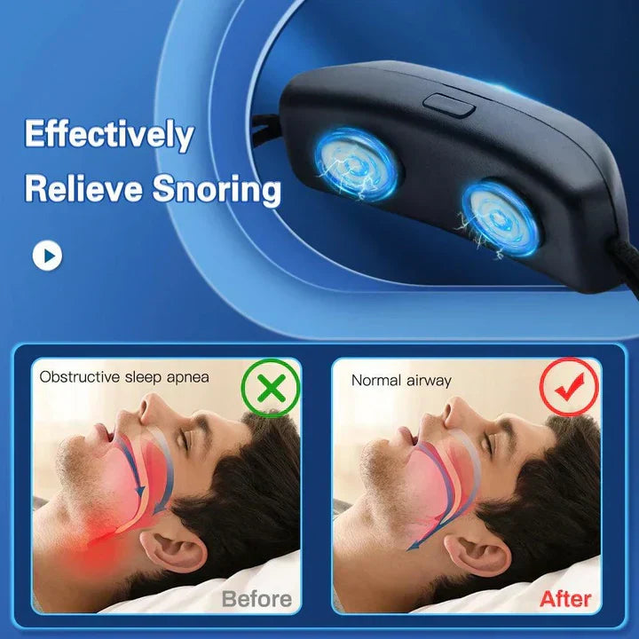 Smart Wearable Anti-Snoring Device
